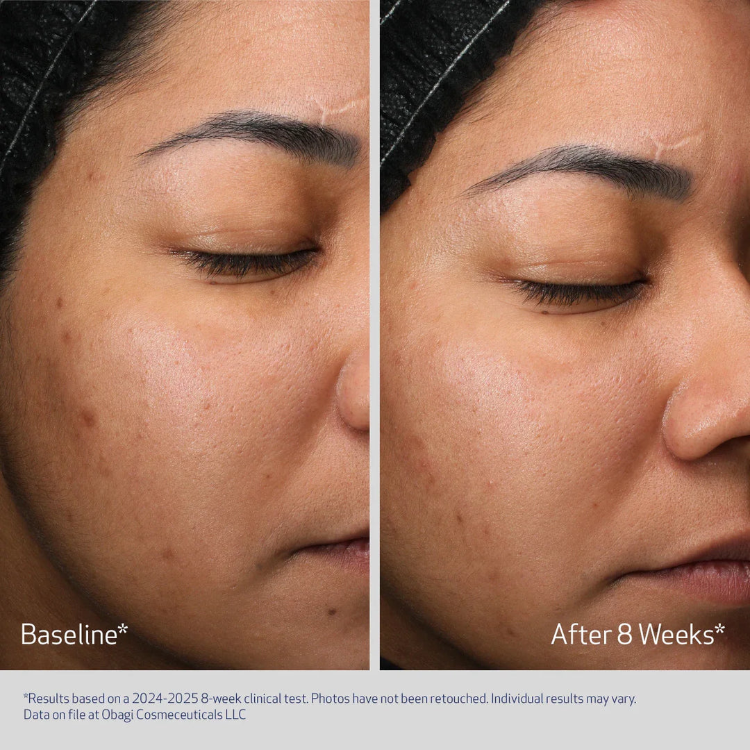 Retinol + PHA Night Cream Obagi