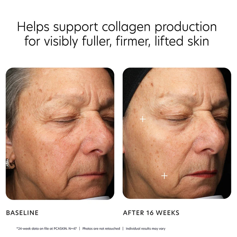 PCA SKIN MGF Age Renewal Cream